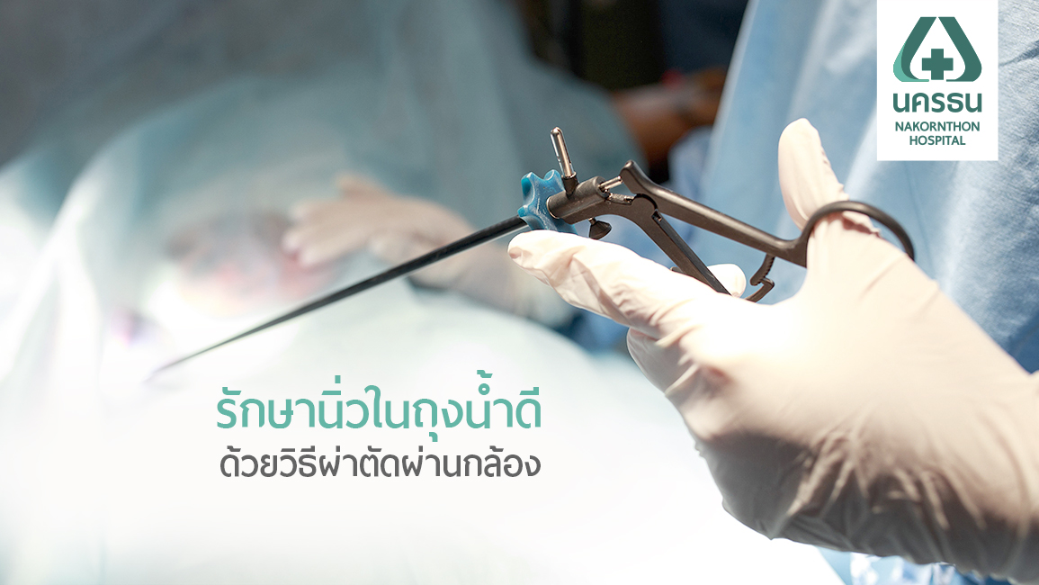 วิเคราะห์ข้อดี-ข้อจำกัด การผ่าตัดผ่านกล้องแบบเจาะลึก รักษานิ่วในถุงน้ำดี